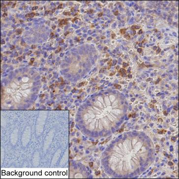 Mouse Anti-Human IL6 Monoclonal Antibody, clone 20 (DMABB-JX195)