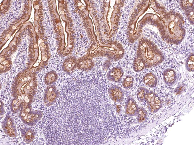 Mouse Anti-Human p21 monoclonal antibody, clone JID132 (CABT-L2847)