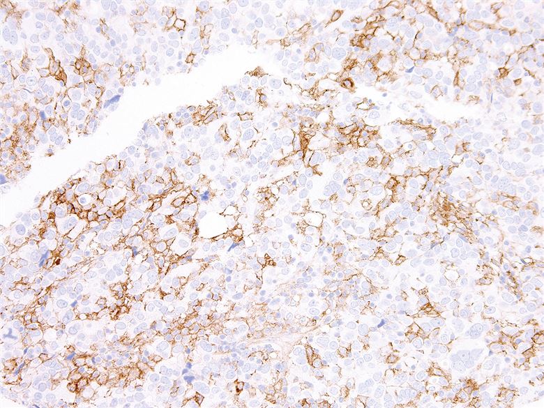 Mouse Anti-Human PD-L1 monoclonal antibody, clone JID522 (CABT-L2928)